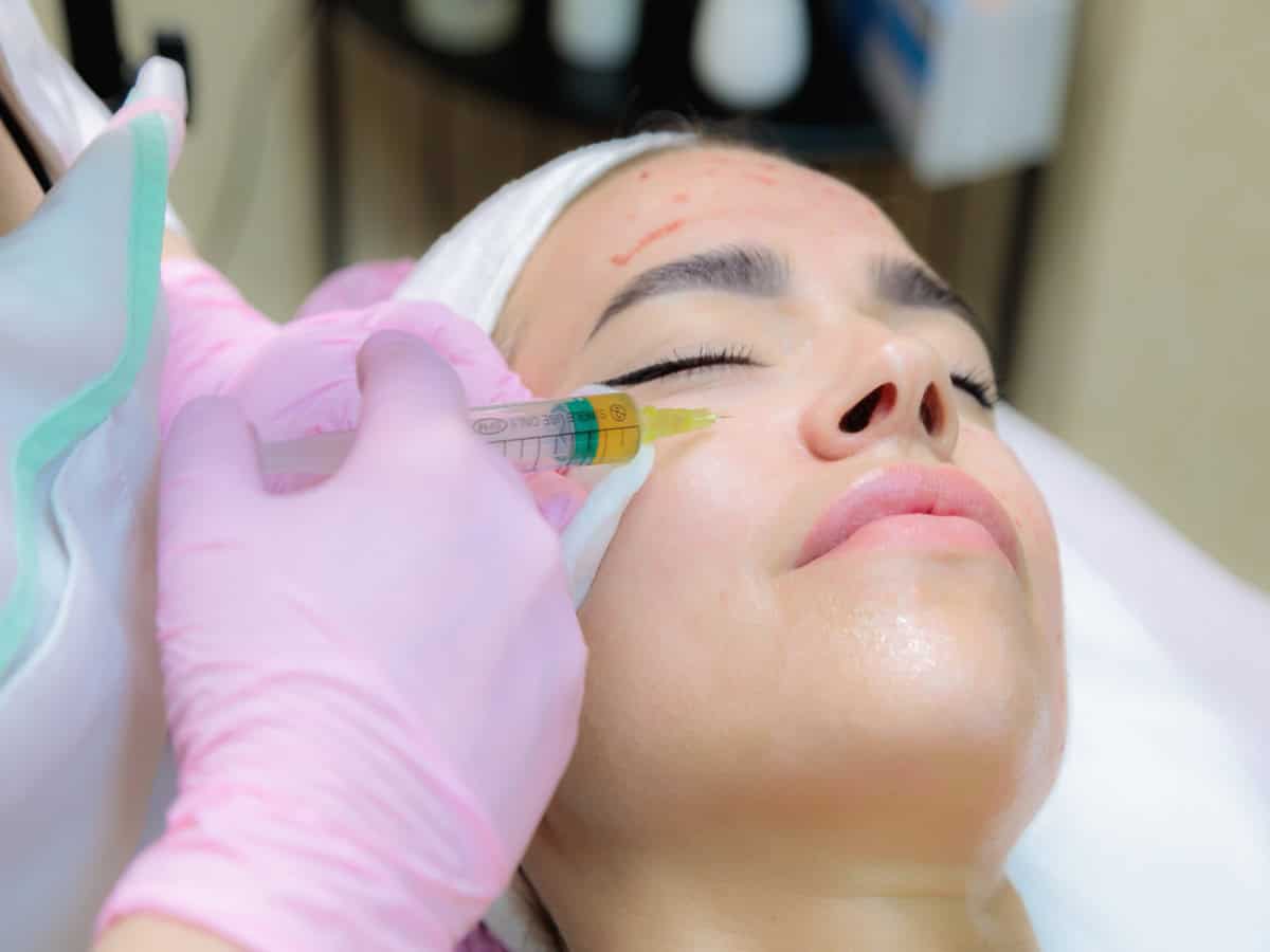 How Long Does It Take for Filler to Stimulate Collagen?