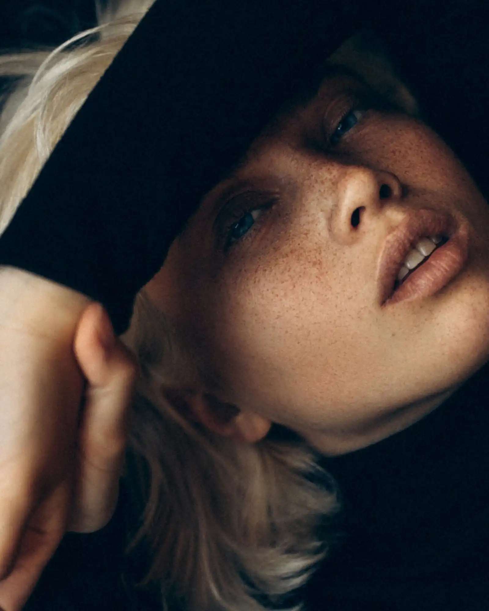 Smoother and more even complexion with Chemical Peels in Auburn, MA at One Eleven RX