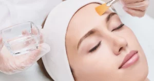 Woman receiving a chemical peel in a spa setting, eyes closed and relaxed, while a professional applies the solution to her forehead with a brush in Auburn, MA